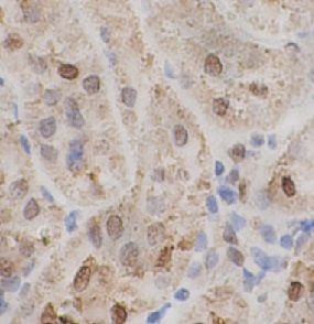 anti- TADBP antibody