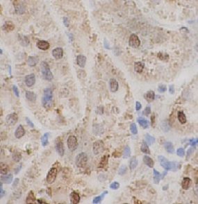 anti- TADBP antibody