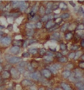 anti- TRAF2 antibody