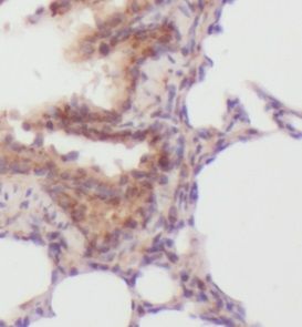 anti- MSI1 antibody
