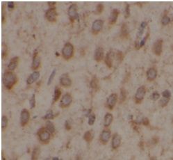 anti- USP10 antibody