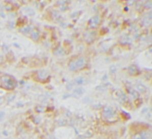 anti- PGBM antibody