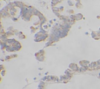 anti- RAD51 antibody