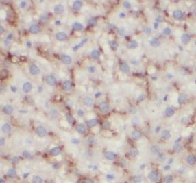 anti- CD16 polyclonal antibody