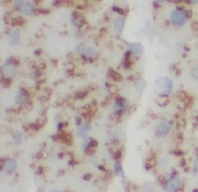 anti- IL5 antibody