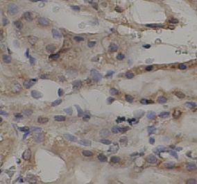 anti- TNFAIP3 antibody