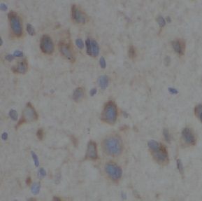 anti- TAB2 antibody