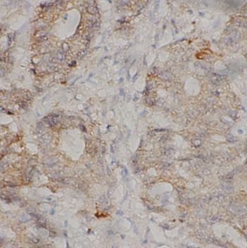 anti- MED17 antibody