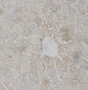 anti- KIR2DS3 antibody