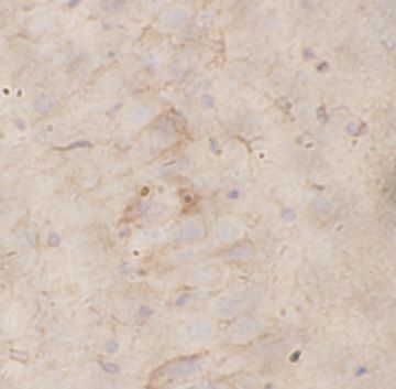 anti- VHL antibody