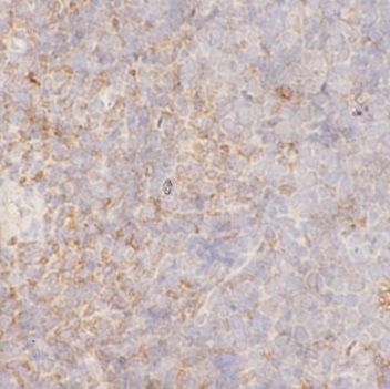 anti- ETV6 antibody