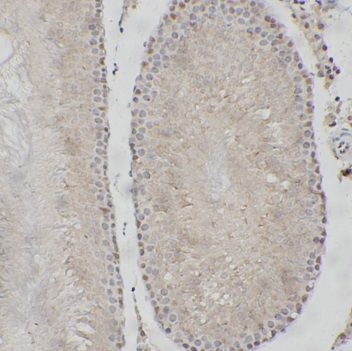 anti- CIC antibody