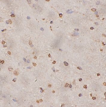 anti- EGLN1 antibody