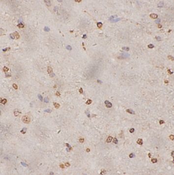 anti- EGLN1 antibody