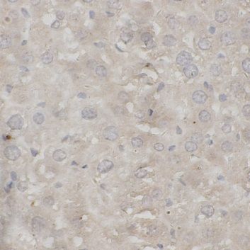 anti- FA5 antibody