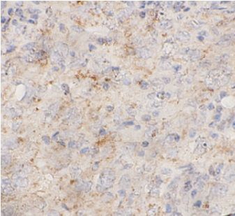 anti- KS6A1 antibody