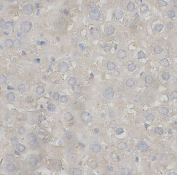 anti- CO2 antibody