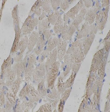 anti- MYPC3 antibody