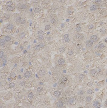 anti- ANO6 antibody