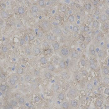 anti- ANGL8 antibody