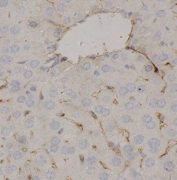 anti- FIBA antibody