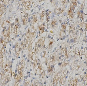 anti- SHBG antibody