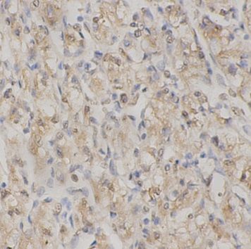 anti- CASP9 antibody