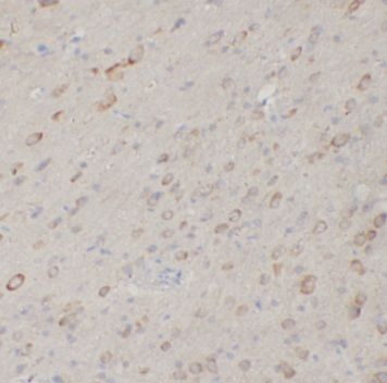 anti- PSPB antibody