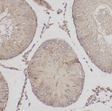 anti- LTOR1 antibody