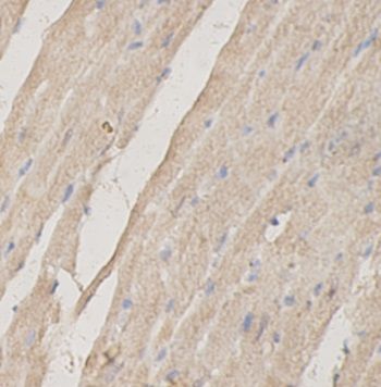 anti- INLR1 antibody