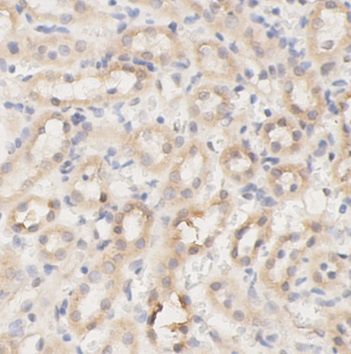 anti- ESR2 (estrogen receptor 2 (ER beta)) antibody