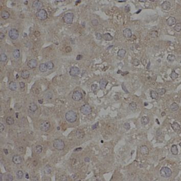 anti- TOLLIP antibody