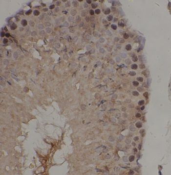 anti- IRAK4 antibody