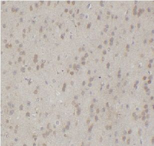 anti- mapk11 antibody