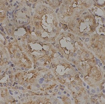 anti- ikke antibody