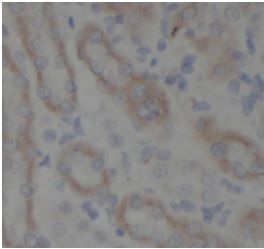 anti- rask antibody