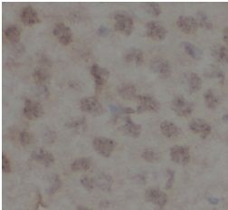 anti- sumo antibody