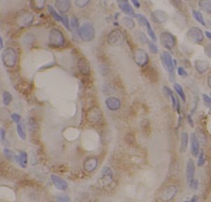 anti- IRAK1 antibody