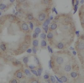 anti- HSP60 antibody