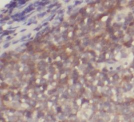 anti- IRF7 antibody