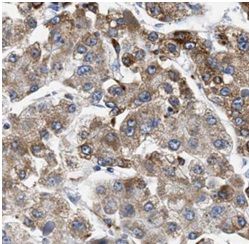 anti- GLUT9 antibody