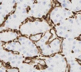 anti- BSEP antibody