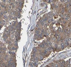 anti- IRE1 antibody