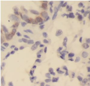anti- IL1 beta antibody