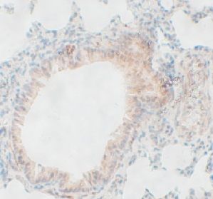 anti- PTGIS antibody