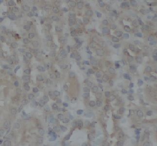 anti- PRKCG antibody