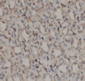 anti- RPS6KB2 antibody