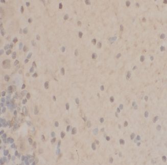 anti- PP1A antibody