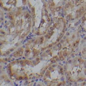 anti- SCF antibody