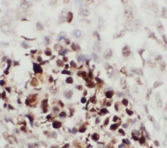 anti- ITCH antibody